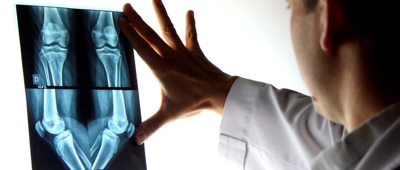 Chirurgie orthopédique & traumatologie — Clinique 10 Mars Casablanca
